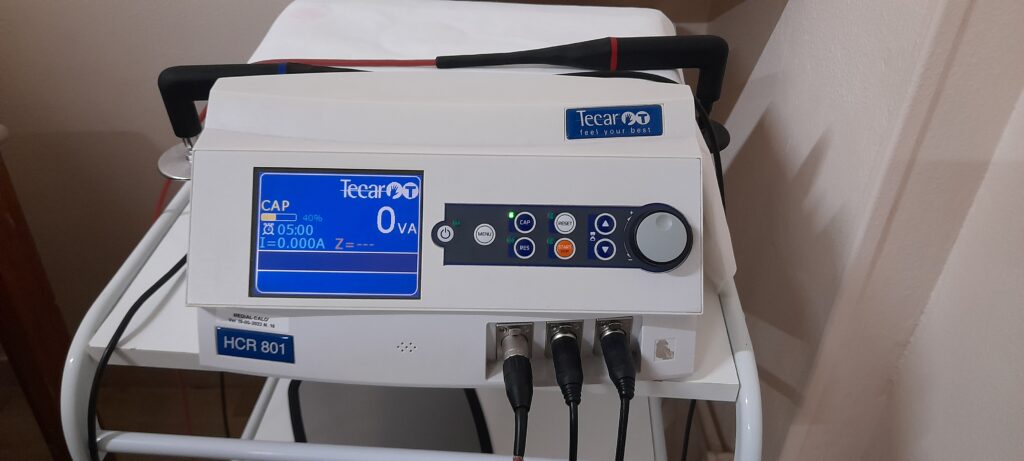 Fisioterapia post trauma a Foggia